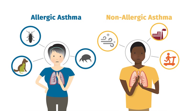 Homeopathy Treatment for Allergic Asthma