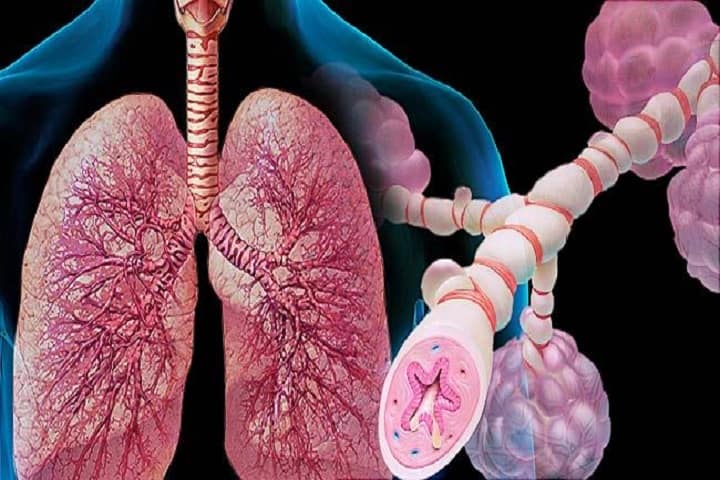 Homeopathy Treatment for Bronchial Asthma In Kurnool