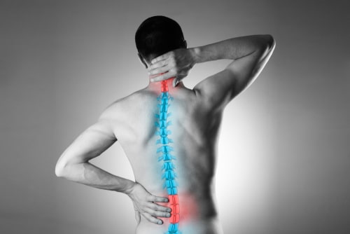 Homeopathy Treatment for Cervical Spondylosis In Kurnool