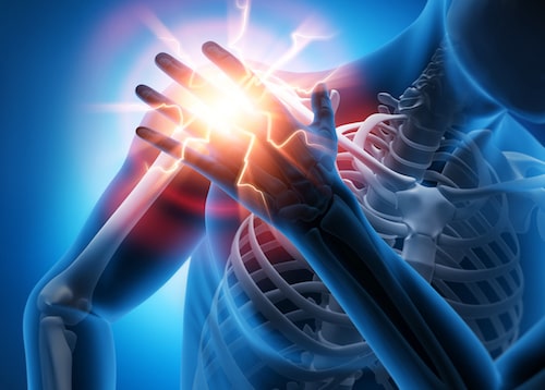 Homeopathy Treatment for Frozen Shoulder In Kurnool