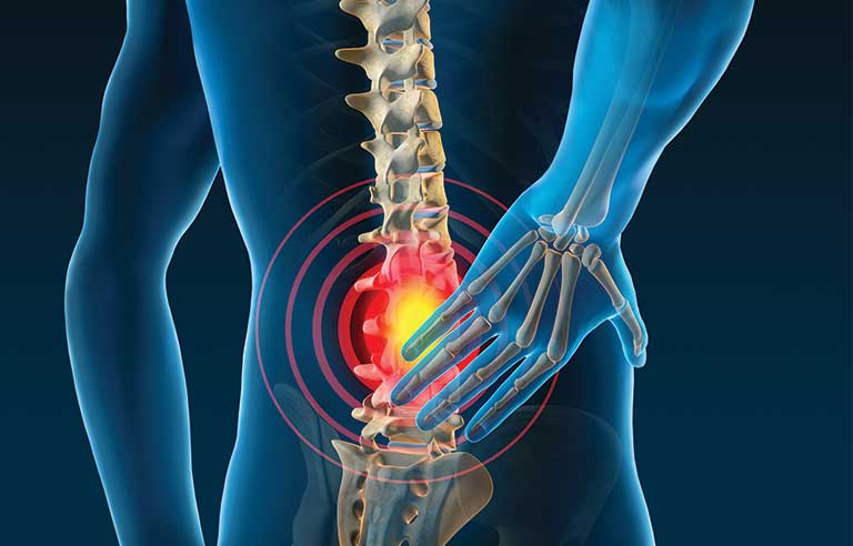 Homeopathy Treatment for Back Pain In Kurnool