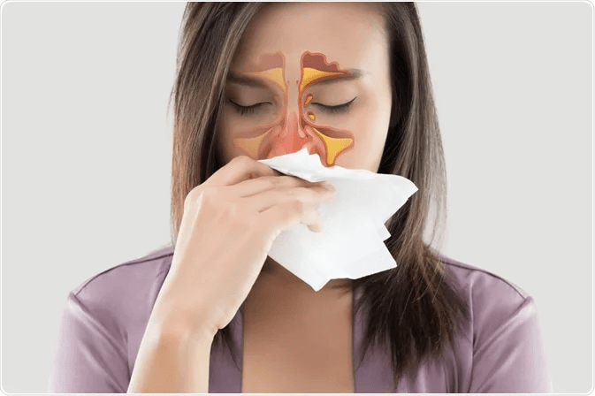Homeopathy Treatment for Sinusitis In Kurnool