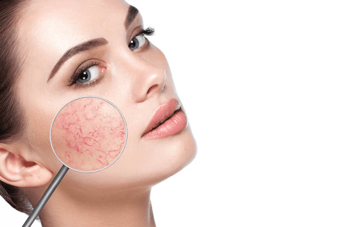 Homeopathy Treatment for Skin Disorders In Kurnool